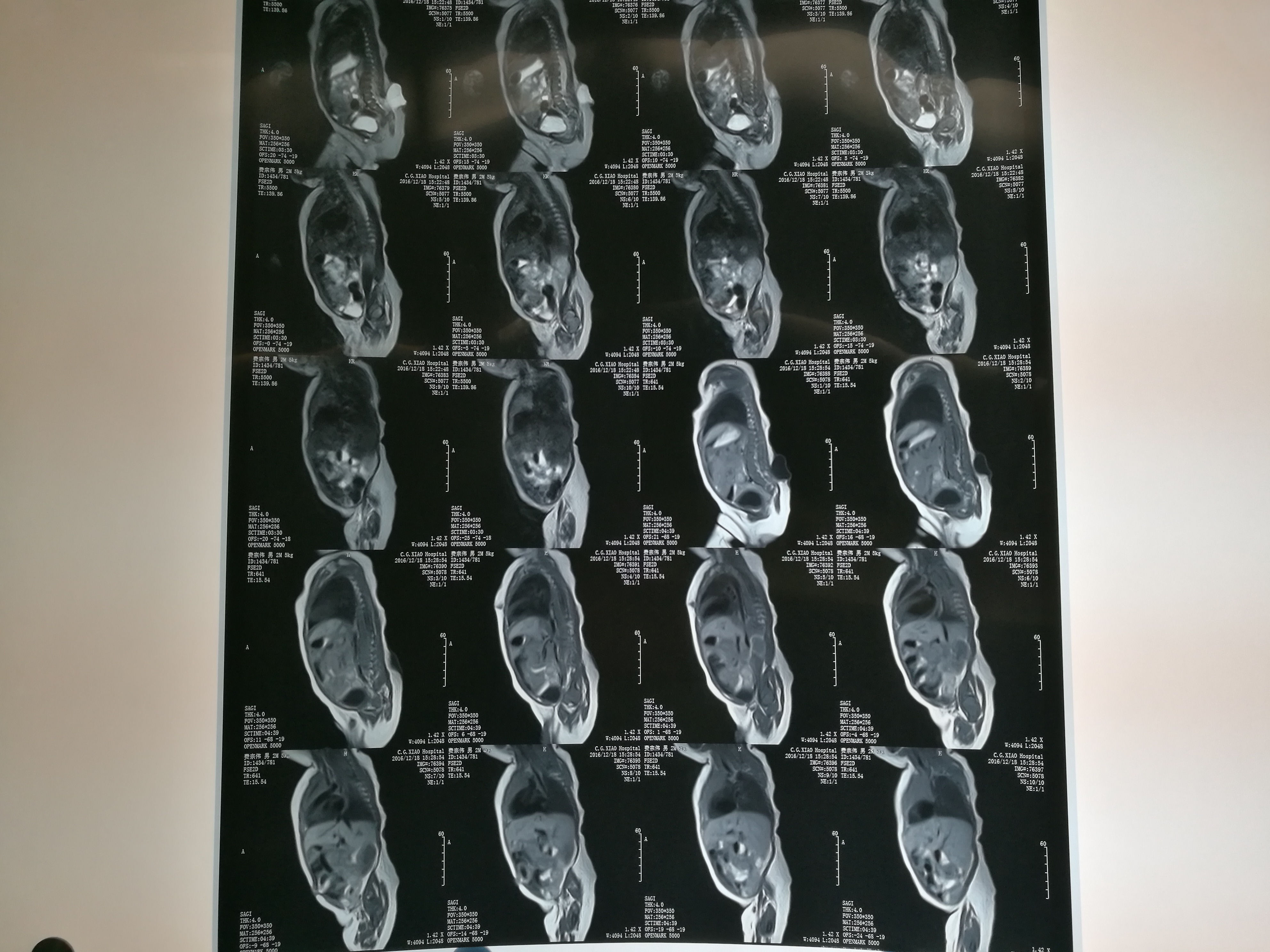 2025年10月17日 第46页